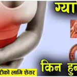 के तपाइलाई ग्यास्ट्रिक छ ? झुक्किएर पनि खाँदै नखानुस् यी खानेकुरा