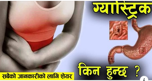 के तपाइलाई ग्यास्ट्रिक छ ? झुक्किएर पनि खाँदै नखानुस् यी खानेकुरा