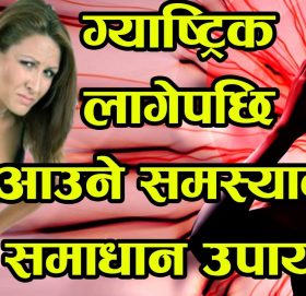 यी कुरा ध्यान दिनु भएन भने ग्याष्ट्रिकले ज्यान लिन्छ