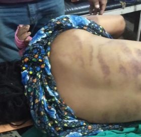 डोटीको जोरायलमा श्रीमान र ससुराद्वारा मरणासन्न हुनेगरी कुटपिट