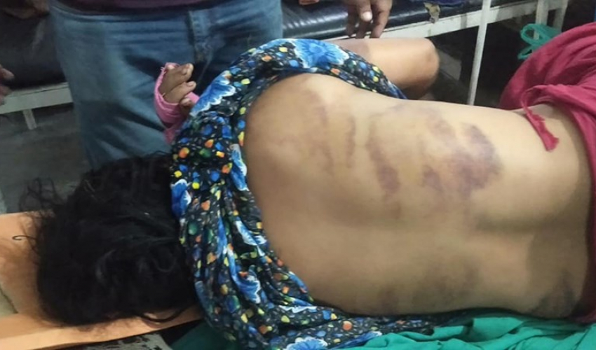 डोटीको जोरायलमा श्रीमान र ससुराद्वारा मरणासन्न हुनेगरी कुटपिट