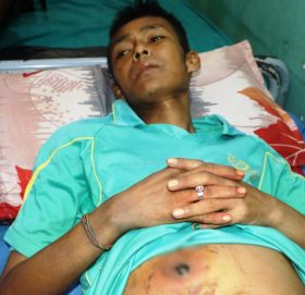 उपचार गराउने बहानामा झाँक्रीले पेटमा प्वाल पारिदिएपछि…