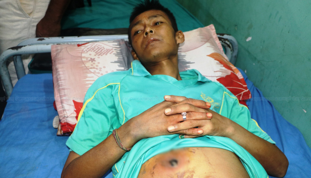 उपचार गराउने बहानामा झाँक्रीले पेटमा प्वाल पारिदिएपछि…