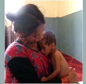 सुदूरपश्चिममा कुपोषणको अवस्था चिन्ताजनक