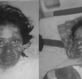 डोटीमा आगो लगाएर हत्या गरेको भन्दै दुई जना विरुद्ध उजुरी