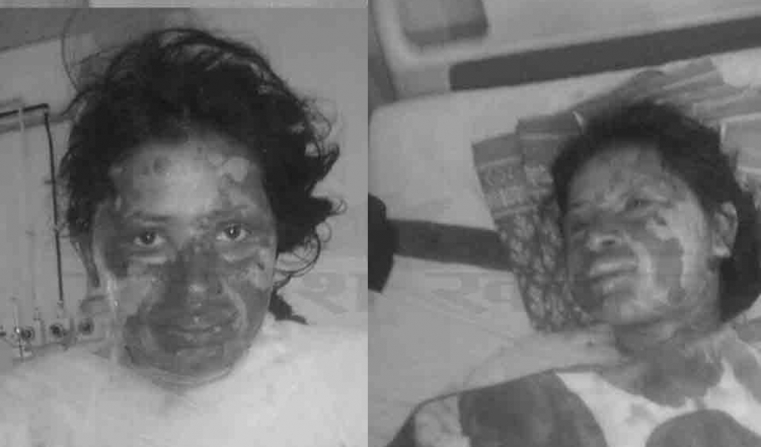 डोटीमा आगो लगाएर हत्या गरेको भन्दै दुई जना विरुद्ध उजुरी