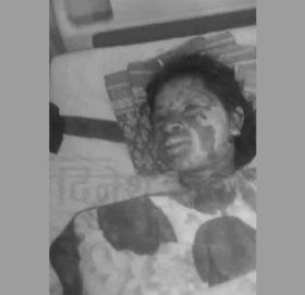 डोटीमा एक युवतीको आगो लगाएर हत्या