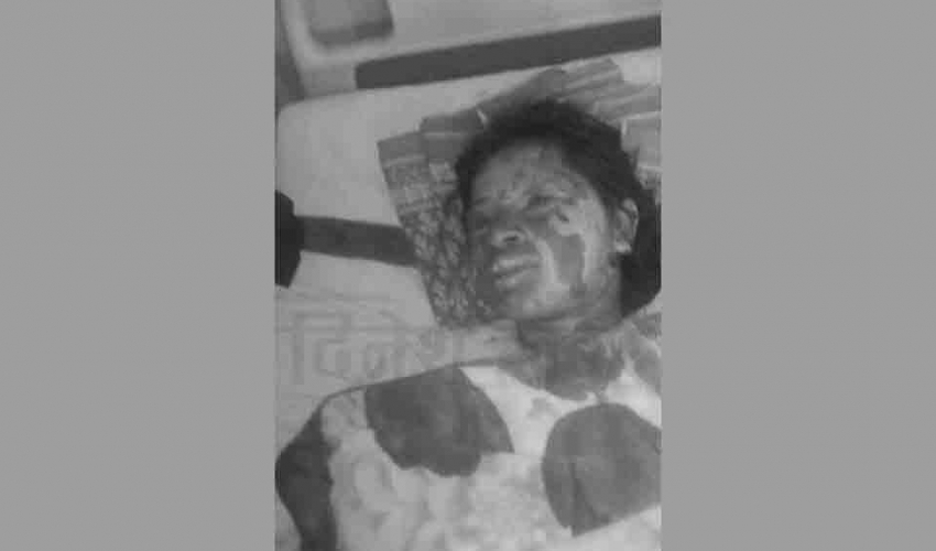 डोटीमा एक युवतीको आगो लगाएर हत्या