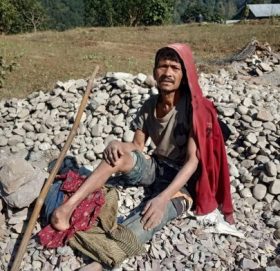 २० बर्षदेखी हारगुहार गरें तर अपांग परिचयपत्र पाउन सकिन