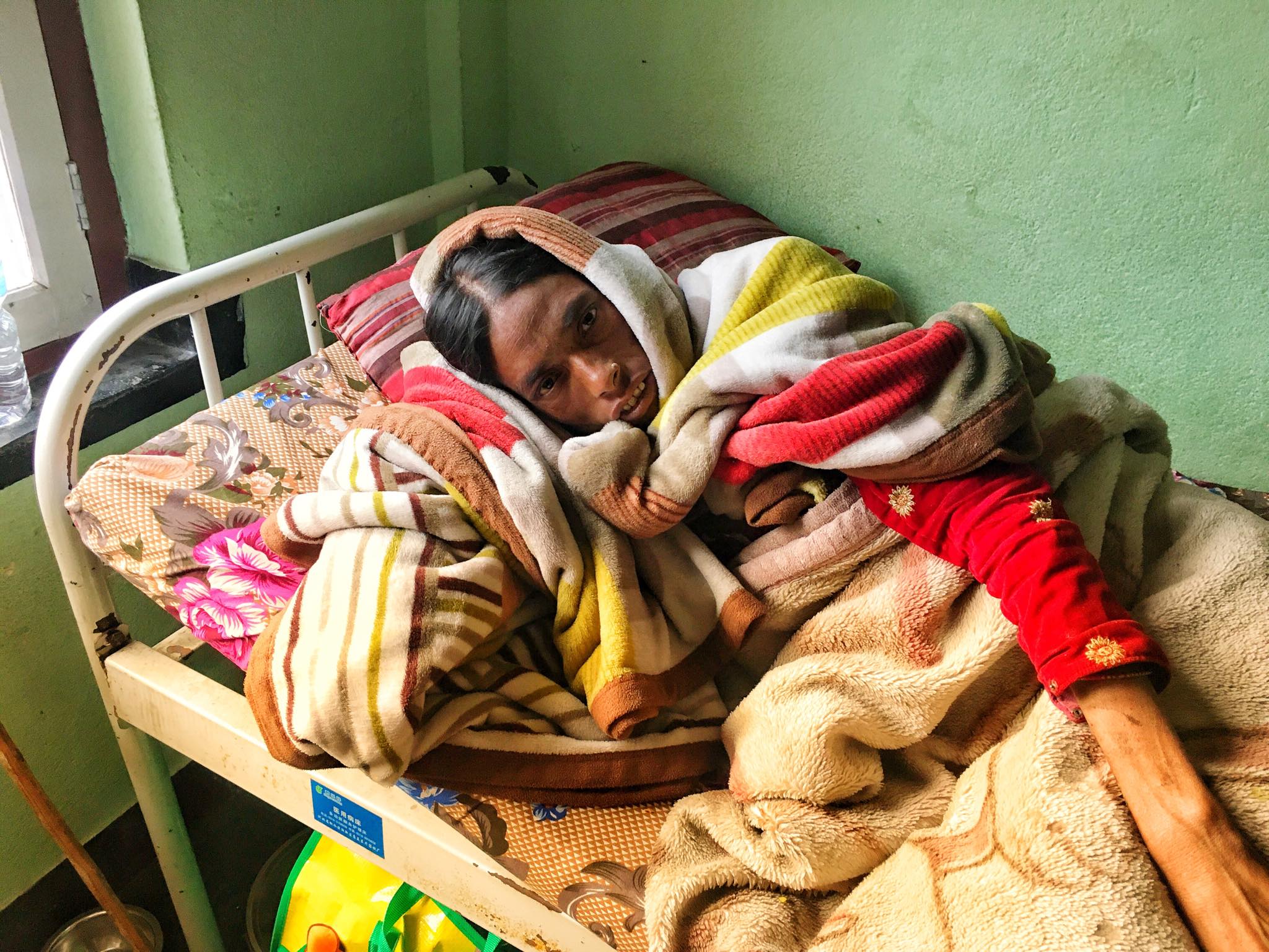 अलपत्र मैना दमाईको उपचार काठमाडौमा हुदै