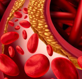 कोलेस्ट्रोलको समस्याले सताएको छ ? खानुहोस् यी १२ खानेकुराहरु