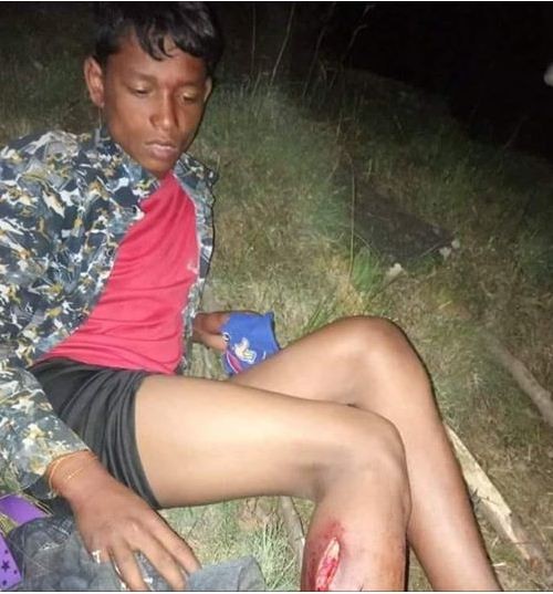 चितुवाको आक्रमणबाट  १ जना घाइते