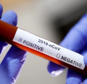 बाजुरामा काेराेना भाइरस ¥यापिट टेस्ट किट र भिटिएमको अभाव