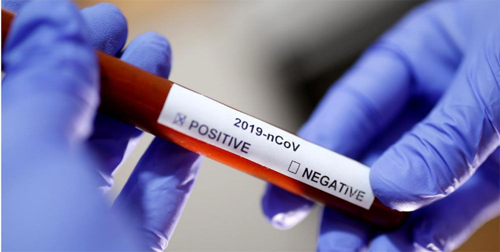 बाजुरामा काेराेना भाइरस ¥यापिट टेस्ट किट र भिटिएमको अभाव