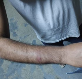 डाक्टरहरूमाथि कुटपिट भएको घटनामा अनुसन्धान गर्न छानबिन समिति गठन