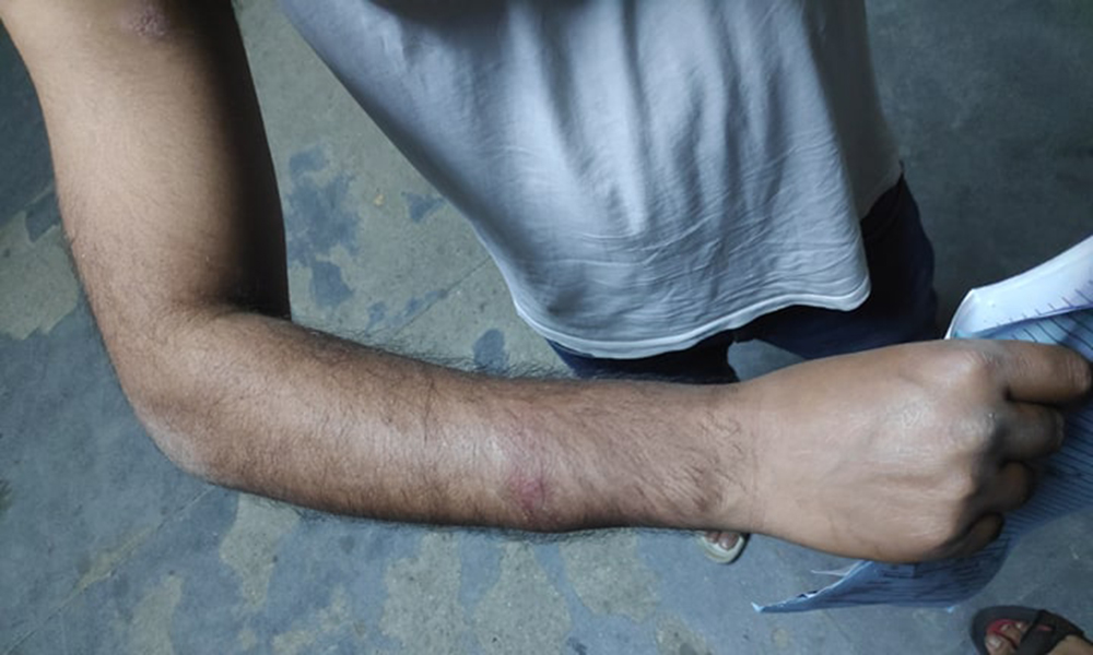 डाक्टरहरूमाथि कुटपिट भएको घटनामा अनुसन्धान गर्न छानबिन समिति गठन