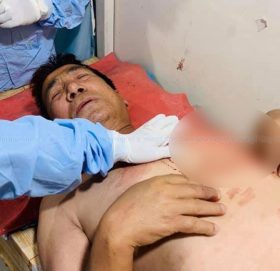 लकडाउन उलंघन रोक्न खोज्दा कांग्रेस नेतामाथि छुरा प्रहार