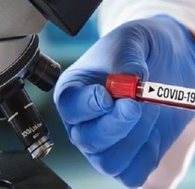 बाजुरामा थप १ जनामा र्‍यापिड टेस्टमा पोजेटिभ, जिल्ला अस्पताल बाजुरा ल्याइदै