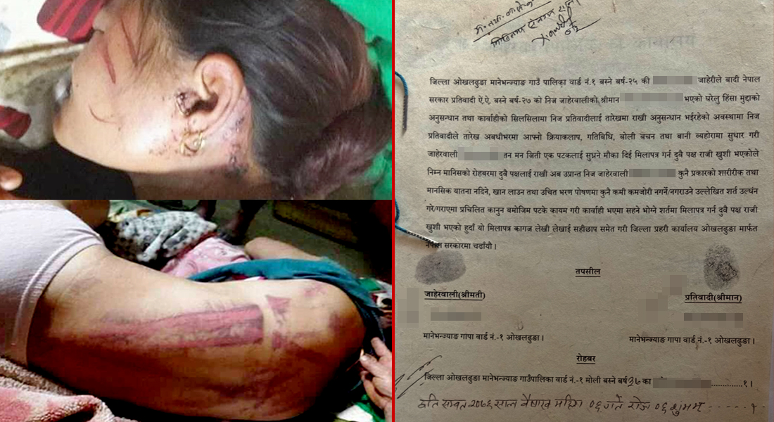 मार्न खोज्नेसँग ‘मिलापत्र’