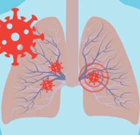 निको भएका बिरामीको परीक्षण पोजेटिभ देखिनु पुनः संक्रमण होइन, फोक्सोको मृत कोसिका हुनसक्छः डब्ल्यूएचओ
