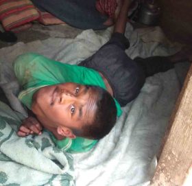 जन्मेदेखी १९ बर्षको उमेर सम्म ओछ्यानमै अलपत्र (भिडियो सहित)