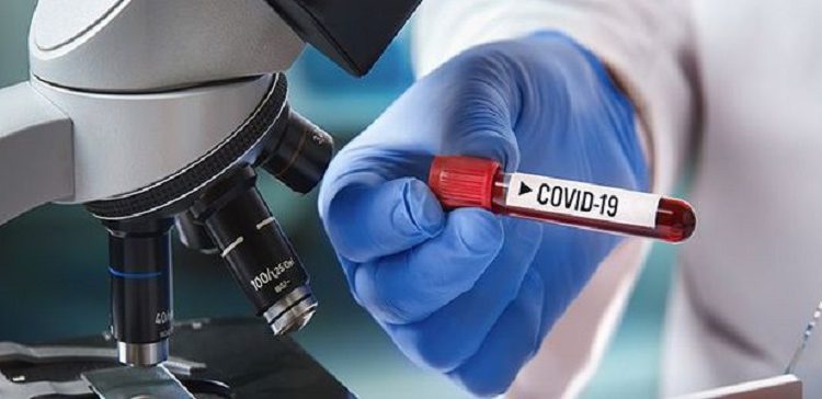 खप्तड छेडेदह र बुढिगंगामा एक/एक जना र त्रिबेणीमा २ जनामा आरडिटी पोजेटीभ