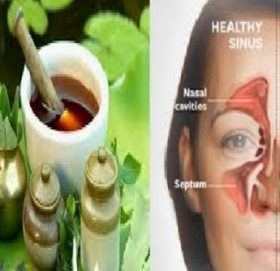 कुन-कुन खानेकुराले गराउन सक्छ एलर्जी ?