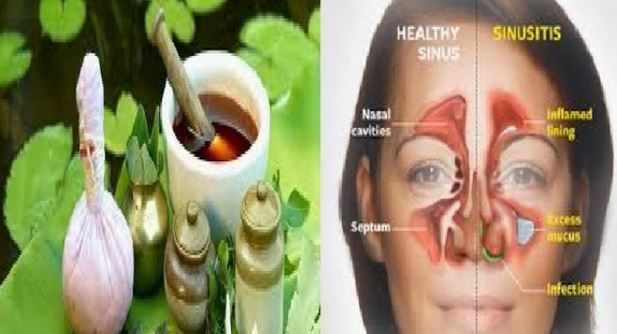 कुन-कुन खानेकुराले गराउन सक्छ एलर्जी ?