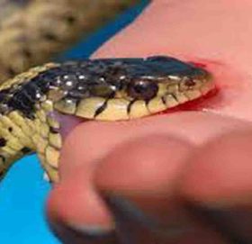 सर्पले डस्दा  एक बालकको मृत्यु