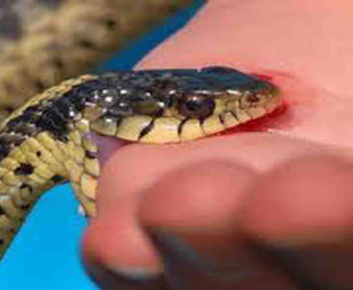 सर्पले डस्दा  एक बालकको मृत्यु