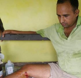 बँदेलको आक्रमणबाट तीन जना घाइते