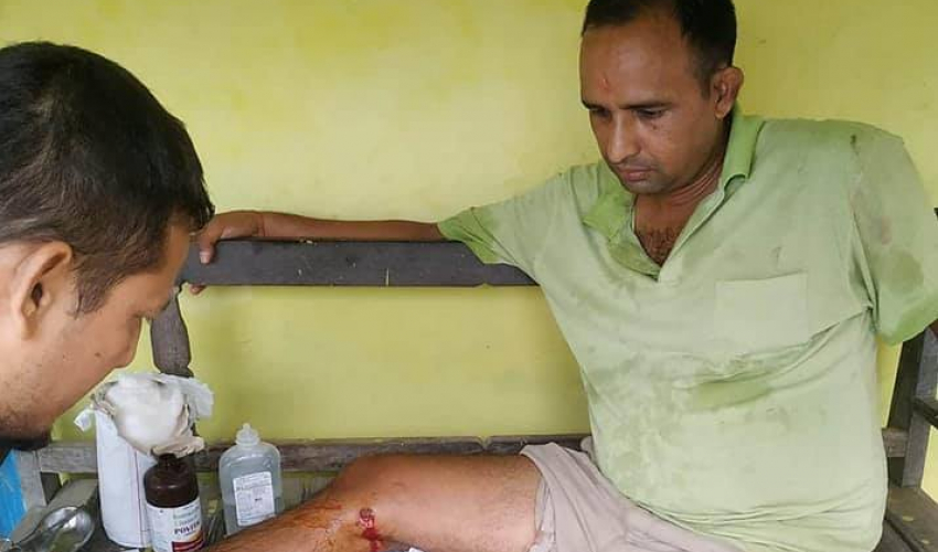 बँदेलको आक्रमणबाट तीन जना घाइते