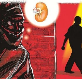 अस्पतालकै संलग्नतामा यसरी गरियो मिर्गौलाको किनबेचदेखि प्रत्यारोपणसम्म