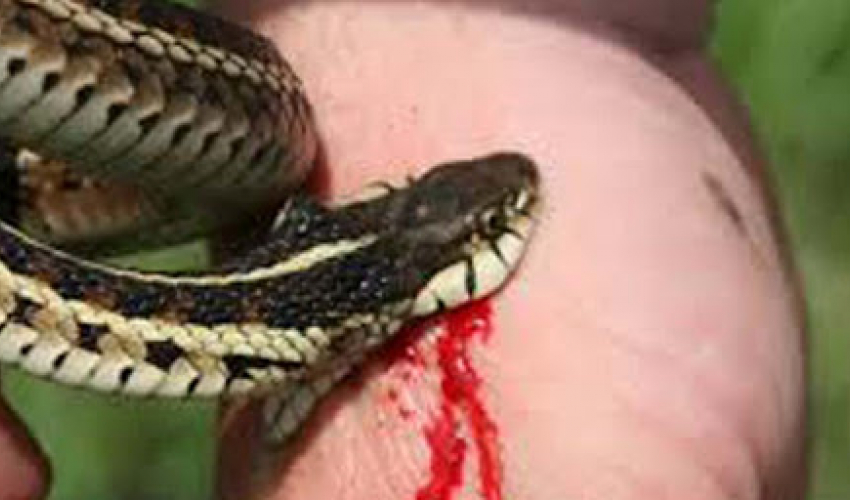 बैतडीमा सर्पले डसेर एक जनाको मृत्यु