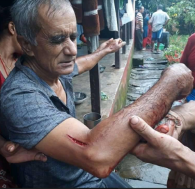 जसले चितुवासँग कुस्ती खेलेर आफूलाई बचाए