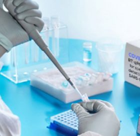 सरकारले पीसीआर परीक्षणको मूल्य २४ सय रुपैयाँ घटायो