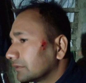 सशस्त्रका इन्सपेक्टरबाट नेपाल प्रहरीका हवल्दार कुटिए !