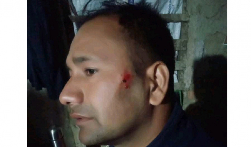 सशस्त्रका इन्सपेक्टरबाट नेपाल प्रहरीका हवल्दार कुटिए !