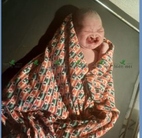 बैतडीमा जन्मियो अनौठो शिशु