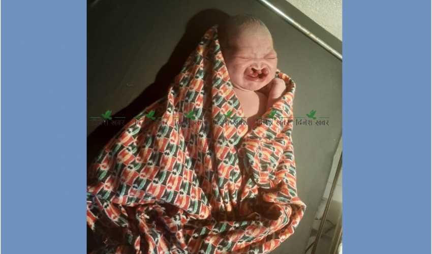 बैतडीमा जन्मियो अनौठो शिशु
