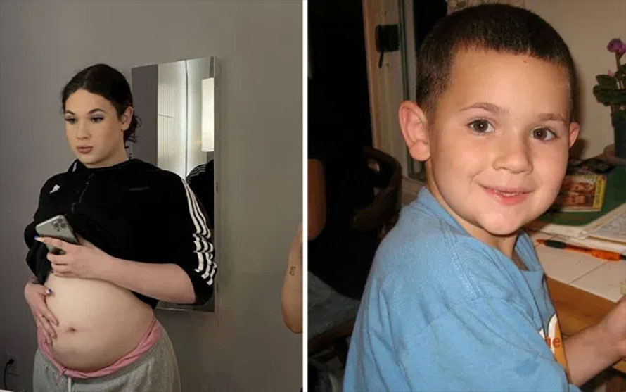 १८ वर्षीय युवकको पेटमा हुर्किँदैछ ४ महिनाको बच्चा