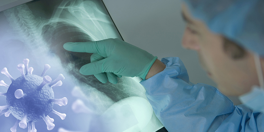 कोरोना सङ्क्रमणमुक्त हुनेको सङ्ख्या बढ्दै