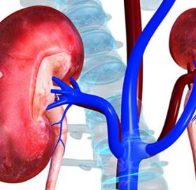 मृत्युपछि डायलासिस पालो