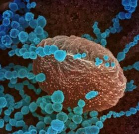 नेपालमा ३ जनामा नयाँ प्रजातिको कोरोना पुस्टि