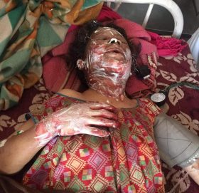 जंगलमा लागेको डढेलोले जलेर घाइते भएकि महिलालाई उपचारमा आर्थिक समस्या