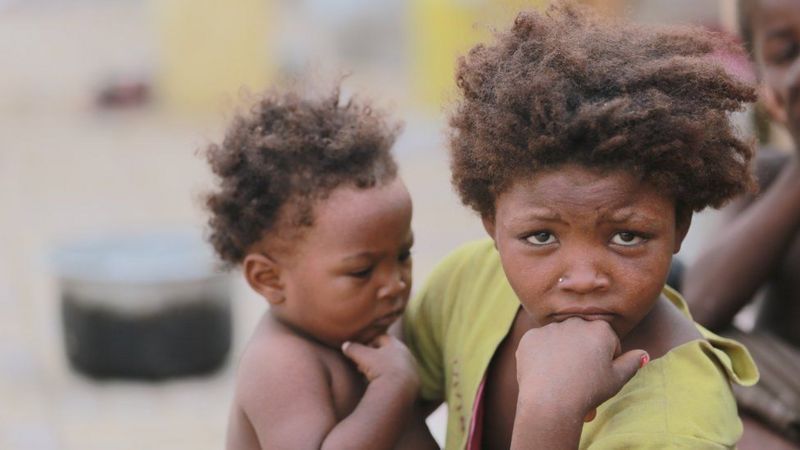 यमनमा २० लाख बालबालिका कुपोषणको चपेटामा पर्छन् – राष्ट्रसंघ