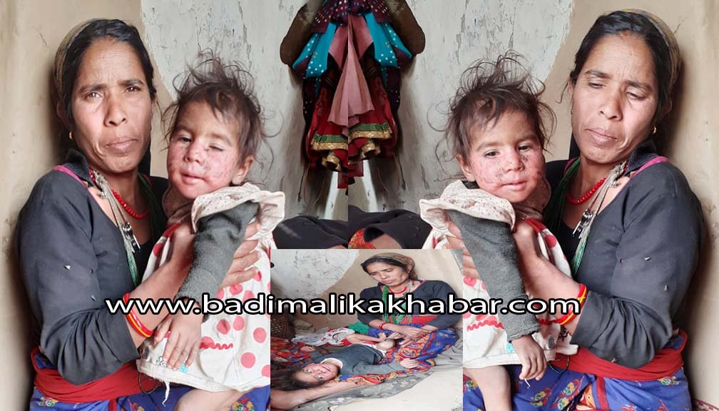 आर्थिक अभाबमा कुपोषित दलित बालिका अलपत्र