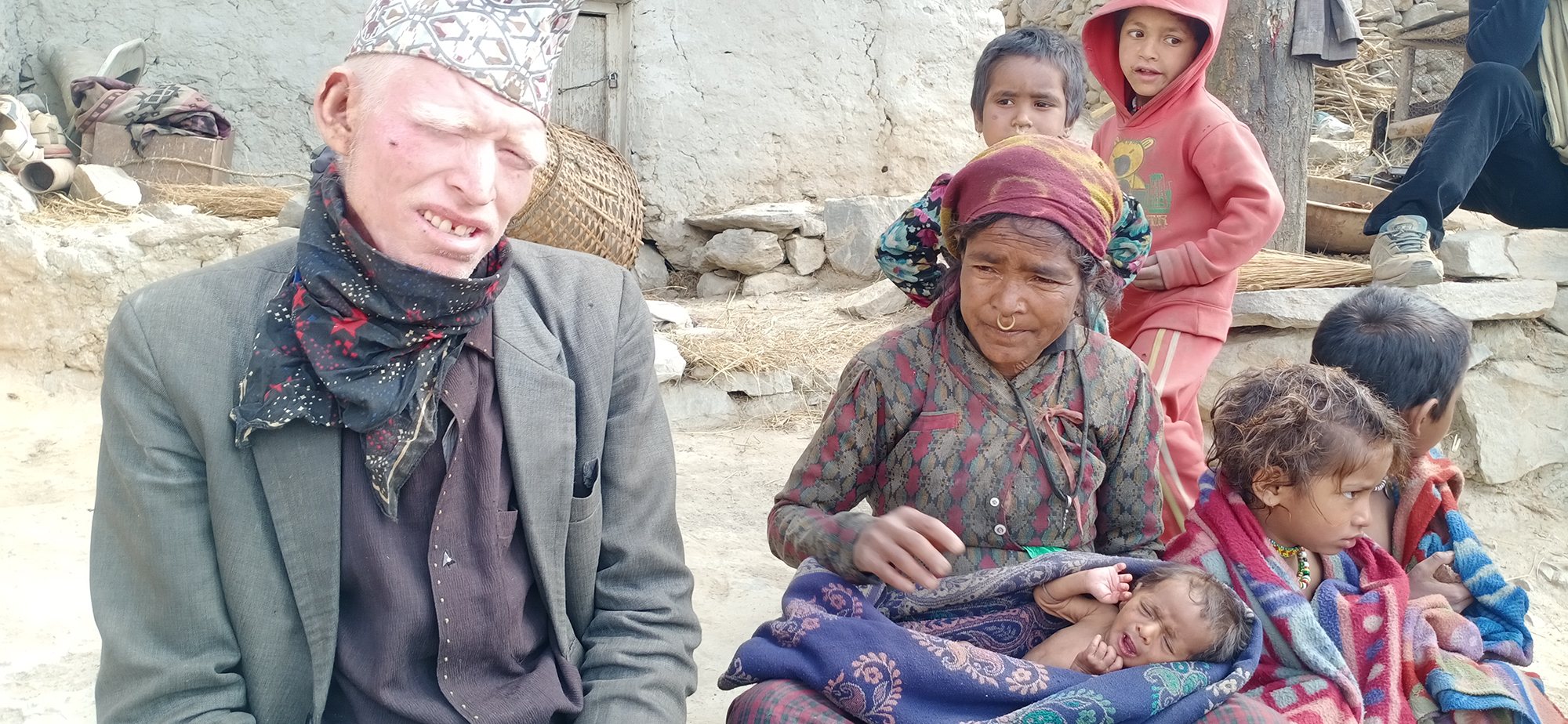 आर्थिक अभाबमा उपचार गर्न नसक्दा एक दलित परिवार बिच्चली