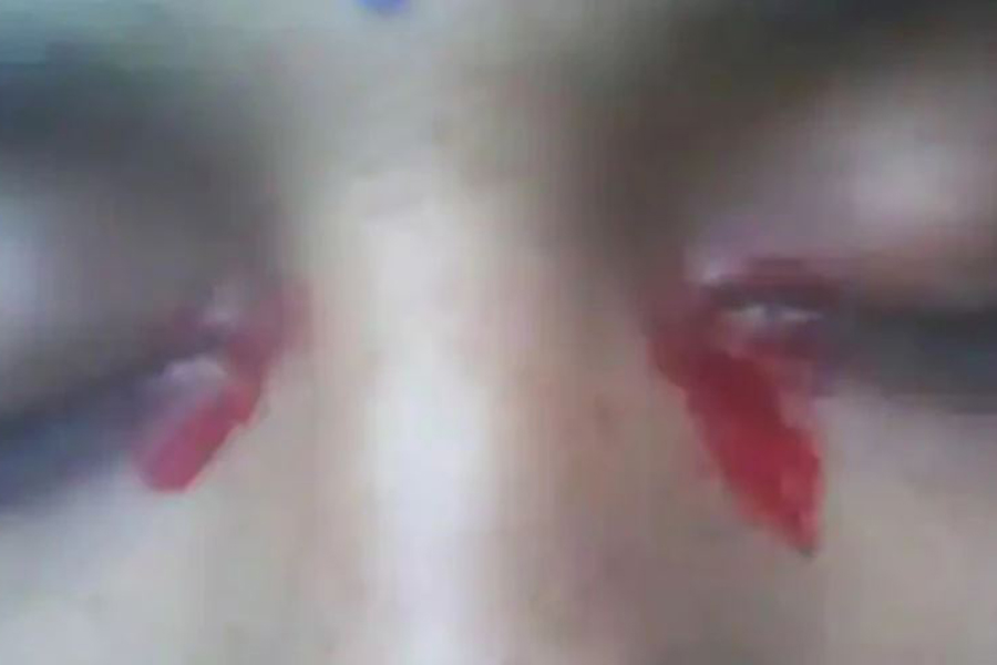 रजश्वलाका बेला रगतका आँसु बगाउने महिला