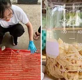 मान्छेको पेटभित्र भेटियो ५९ फुटको जुका